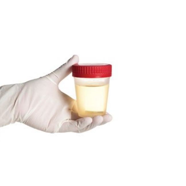 Čaša za urin OMC